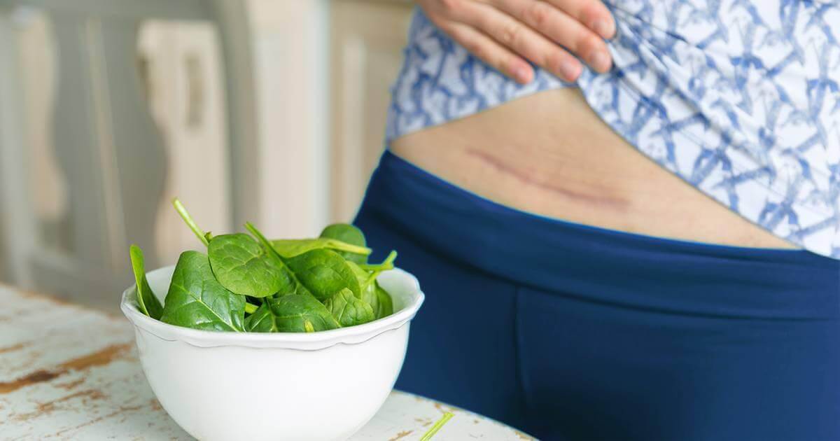 TAKING CARE OF YOUR CAESAREAN SCARS