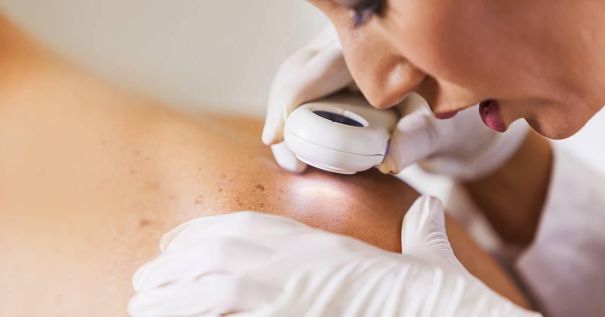 What are scars and why do they form?