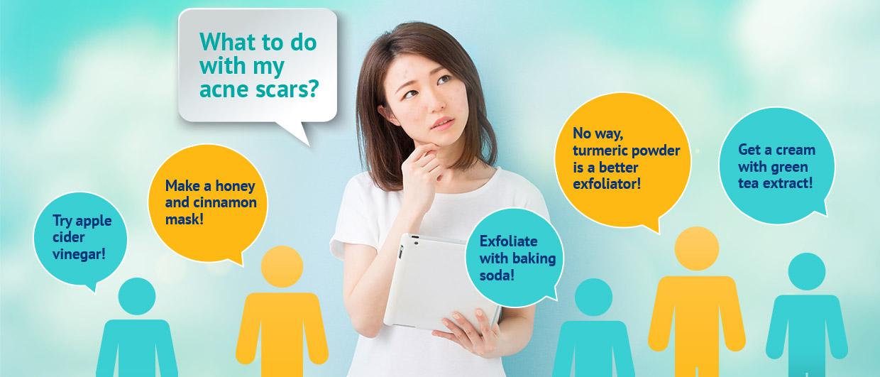 Popular natural “cures” for acne scars