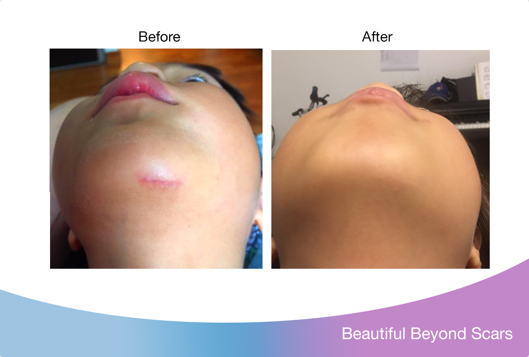 My daughter had to go through a surgery 