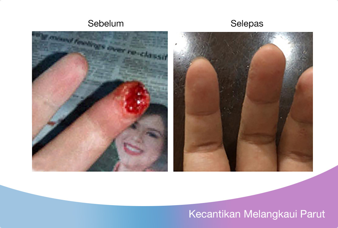 parut saya menjadi lebih lembut dan rata