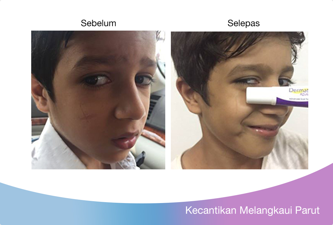 anak saya lebih cerah