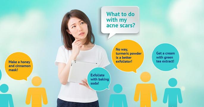 Popular natural “cures” for acne scars